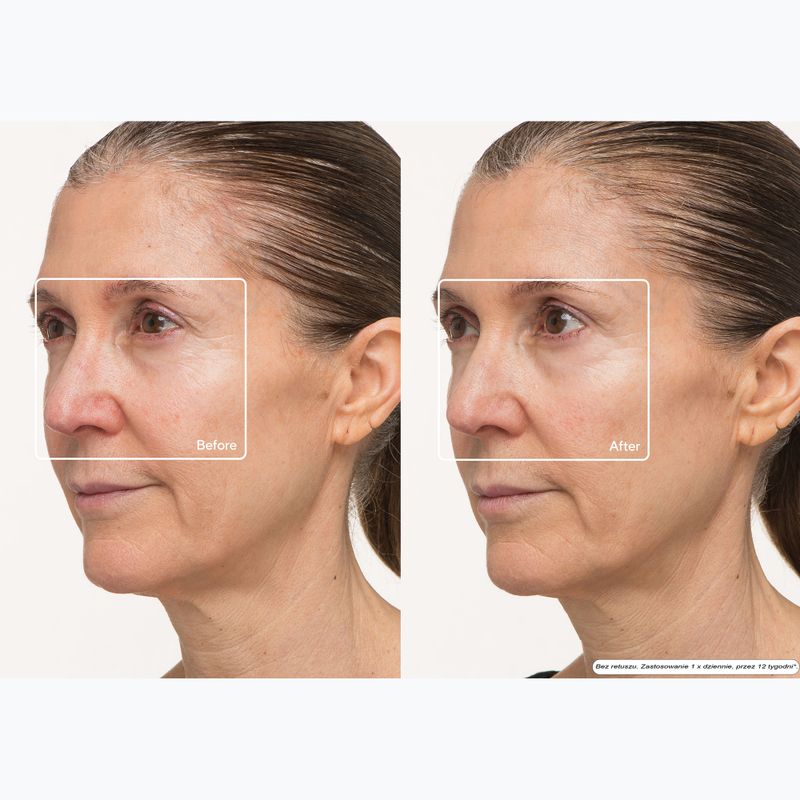 Maska LED na tvár Therabody TheraFace LED Mask 10