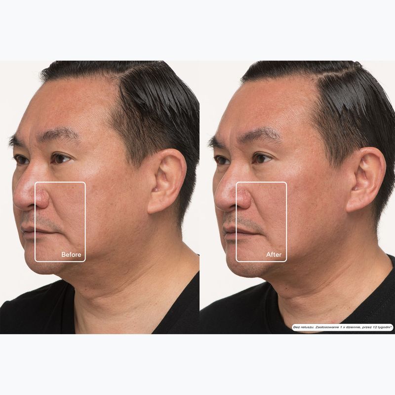 Maska LED na tvár Therabody TheraFace LED Mask 12