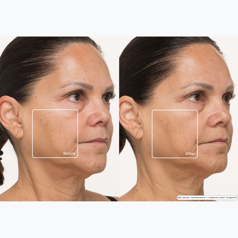 Maska LED na tvár Therabody TheraFace LED Mask 13